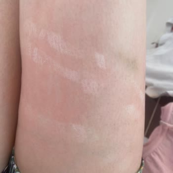 Agiva Renk Açıcı Sprey Vücudumda Reaksiyona Sebep Oldu