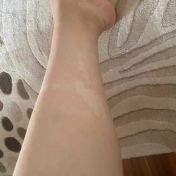 Agiva Renk Açıcı Sprey Vücudumda Reaksiyona Sebep Oldu