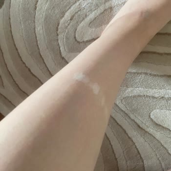 Agiva Renk Açıcı Sprey Vücudumda Reaksiyona Sebep Oldu