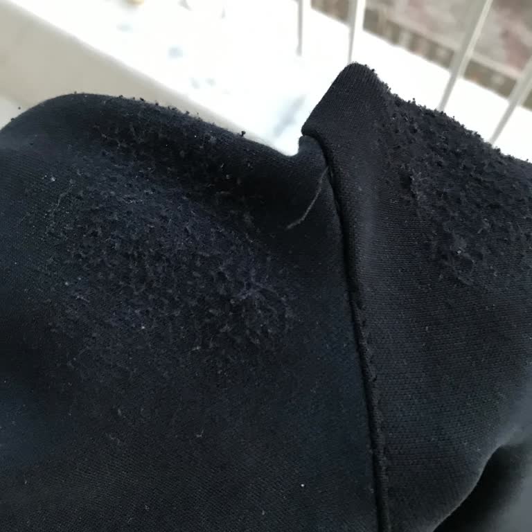 Slazenger 4 Gün İçerisinde Yırtılan Şort.