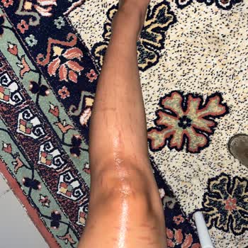 Kiwi Home Kiwi Buz Başlıklı Epilasyon Lazer