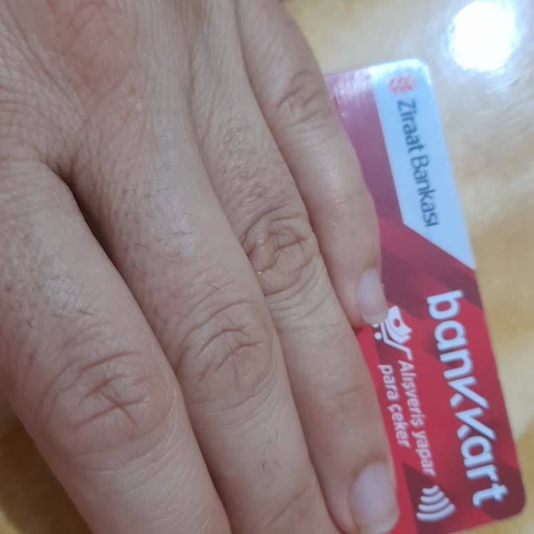 Ziraat Bankası Kartım Bloke Oldu...