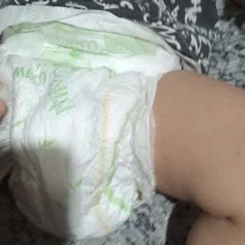 Bebem Natural Üretim Hatası Sarı Çizgi Hatası