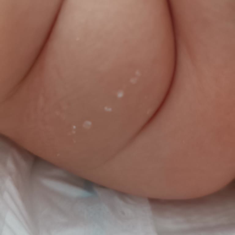 Molfix Hem Sızdırıyor Hem İçi Çıkıyor