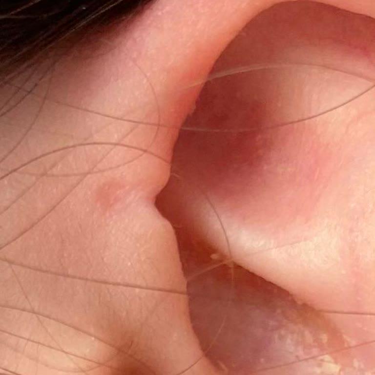 Ivır Zıvır Rock Shop Kopan Kıkırdak Piercingi