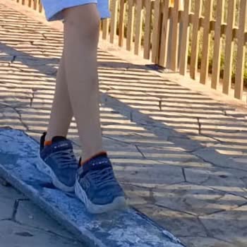 Skechers Ayakkabı Günlük Kullanımda 3 Ayda Sökülmeye Başladı Yırtıldı