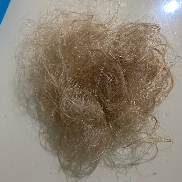 Bioxcin Mağdur Edildim Neredeyse Peruk Kullanacağım