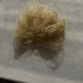 Bioxcin Mağdur Edildim Neredeyse Peruk Kullanacağım