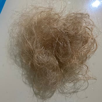 Bioxcin Mağdur Edildim Neredeyse Peruk Kullanacağım