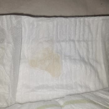 Molfix Bebek Bezi İçinde Cisim