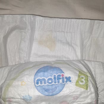 Molfix Bebek Bezi İçinde Cisim
