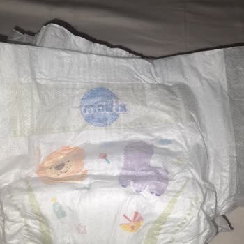 Molfix Bebek Bezi İçinde Cisim