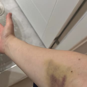 Kızılay Sağlık Grubu Kartal Hastanesi Serumları Bozuk!