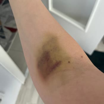 Kızılay Sağlık Grubu Kartal Hastanesi Serumları Bozuk!