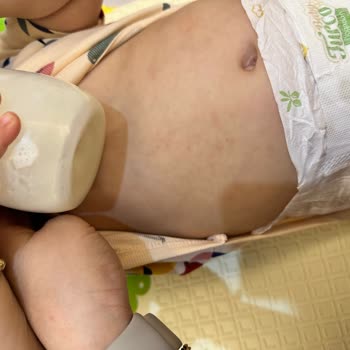 Baby Turco 5 Numaralı Bez Şikayeti