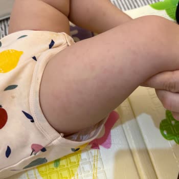 Baby Turco 5 Numaralı Bez Şikayeti