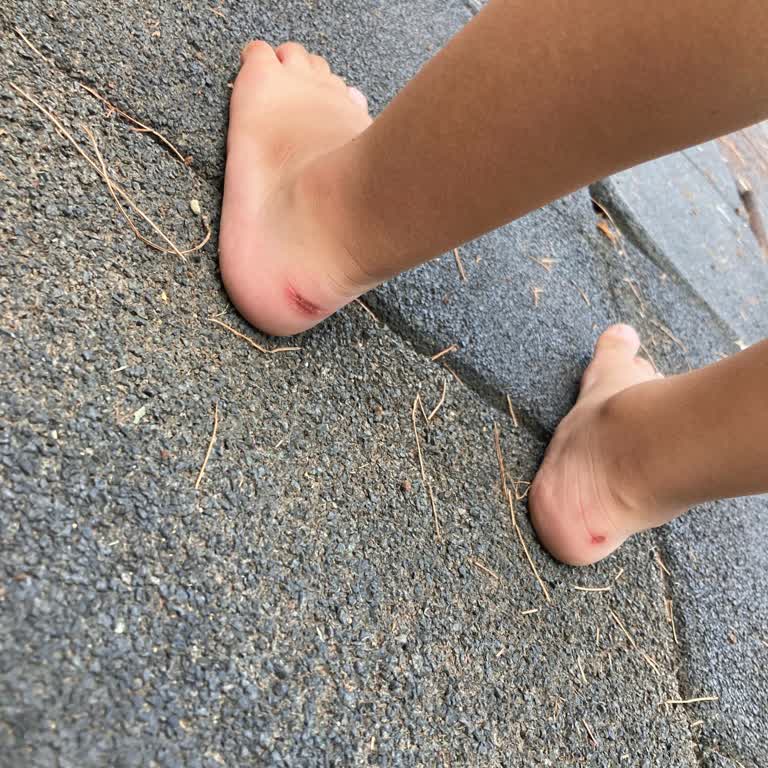 İgor Marka Sandalet Ayak Vuruyor