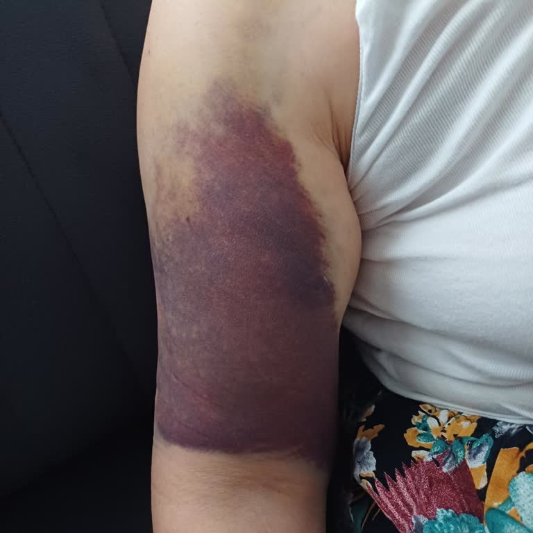 Bolu İzzet Baysal Devlet Hastanesi Acil Servis Doktoru Hakkında Şikayet