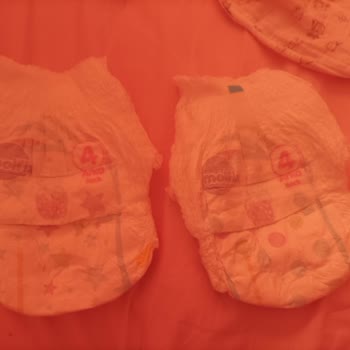 Molfix Külot Bezin Bantları Yok