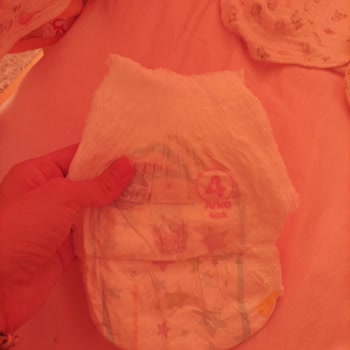 Molfix Külot Bezin Bantları Yok