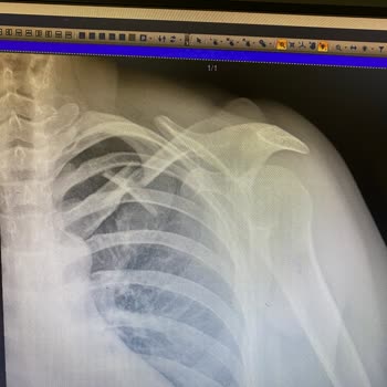 Bosphorus Sorgun Hotel İhmal Ve Sonuç!