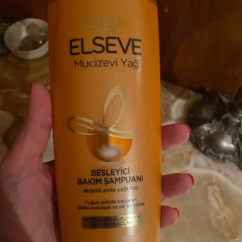 Loreal Paris Elseve Şampuan Korkunç Kaşıntıya Sebep Oldu!
