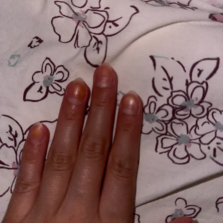 Flormar Oje Turuncu Lekeler Bıraktı