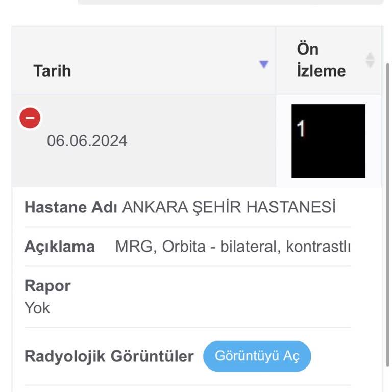 Ankara Bilkent Şehir Hastanesi Radyoloji MR Sonucu Çıkmıyor!