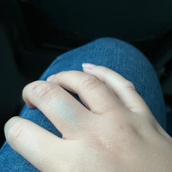 Derimod Yeşil Renk Deri Mont Problemi
