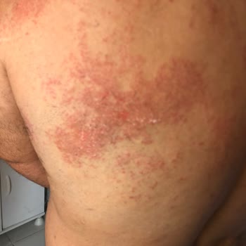 Veet Hassas Ciltler İçin Uygun Olmayan Krem Deneyimi