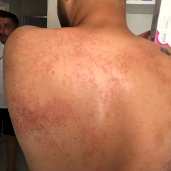 Veet Hassas Ciltler İçin Uygun Olmayan Krem Deneyimi