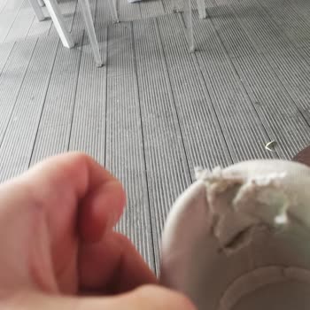 Skechers Ayakkabının Kısa Sürede Deforme Olması