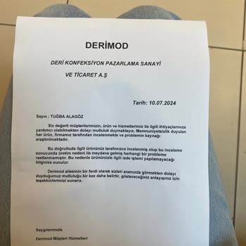 Derimod Ayakkabı Ayağımın Her Yerini Yara Yaptı
