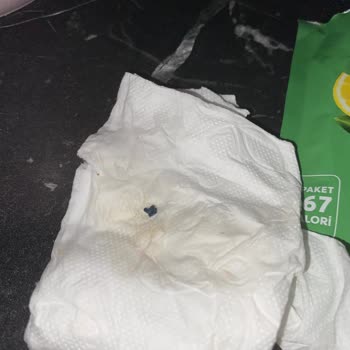 Yayla Bakliyat Yayla Ekşi Mix İn İçinden Çıkan Sert Cisim?