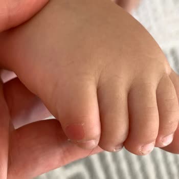 Vicco İlk Adım Ayakkabısı Yara Yaptı