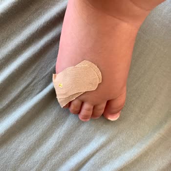 Vicco İlk Adım Ayakkabısı Yara Yaptı