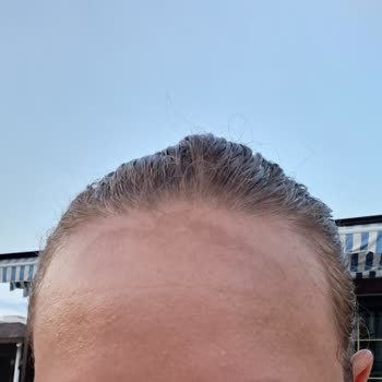 Nivea Luminous Leke Kremi Leke Yaptı