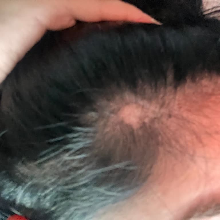 Dax Turkiye Dax Supergro Sacımı Kopardı