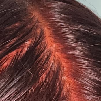 Palette Marka Saç Boyası Kafa Derimi Yaktı