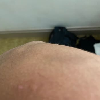 Jolly Tur Otelin Jeneratörünün Yetersiz Kalması