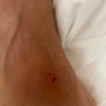 Jolly Tur Otelin Jeneratörünün Yetersiz Kalması