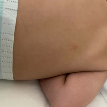 Jolly Tur Otelin Jeneratörünün Yetersiz Kalması