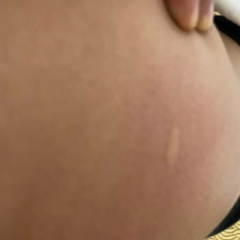 Jolly Tur Otelin Jeneratörünün Yetersiz Kalması