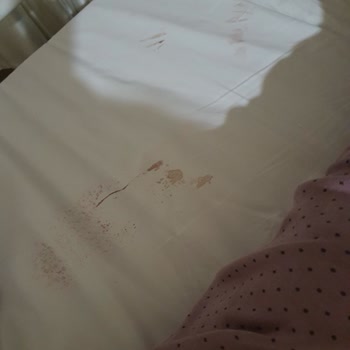 Marmara Üniversitesi Pendik Eğitim ve Araştırma Hastanesi Kötü Bir Hastane