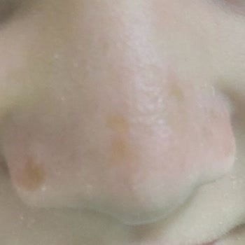 Nivea Güneş Kremi Cilt Tahribat Sorunu