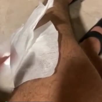 Medical Park Hastanesi Berbat Pansuman Nasıl Yapılır?