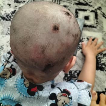 Johnsons Baby Şampuan Şikayeti Var