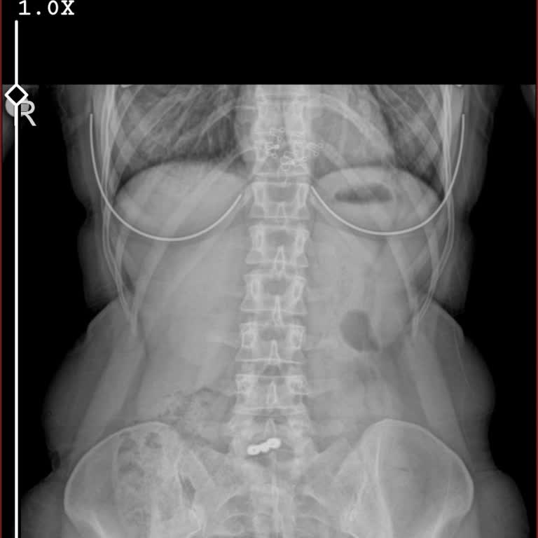 Diş Hekimi Sezaittin Koç Şikayet Memnuniyetsizlik. İlgisizlik