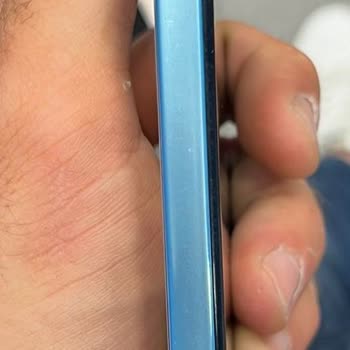 Xiaomi Telefon Teknosa Ve Evofone Garanti Servisi Sorunu