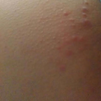 Doctorem Alerji Yaptı İade Kabul Etmiyor